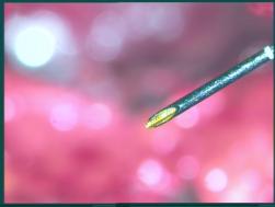 Nadel mit Laserfaser